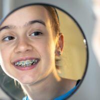 Nyelvlökéses nyelés korrigálása csak fogszabályzó mellett lehetséges? 38351